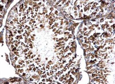 Immunohistochemistry-Paraffin: DCP2 Antibody [NBP2-16109]