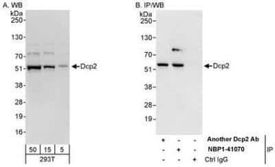 Western Blot: DCP2 Antibody [NBP1-41070]