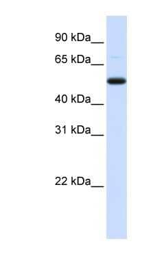 Western Blot: DCP2 Antibody [NBP1-57441]