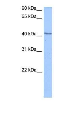 Western Blot: DCP2 Antibody [NBP1-57442]