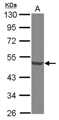 Western Blot: DCP2 Antibody [NBP2-16109]