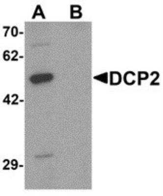 Western Blot: DCP2 AntibodyBSA Free [NBP2-81810]