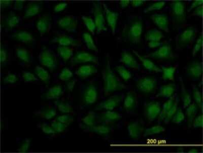 Immunocytochemistry/ Immunofluorescence: DCPS Antibody (1G4) [H00028960-M02]