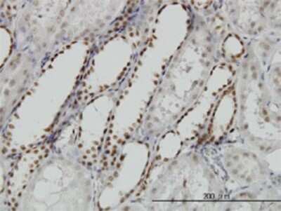 Immunohistochemistry-Paraffin: DCPS Antibody (1G4) [H00028960-M02]