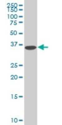 Western Blot: DCPS Antibody (1G4) [H00028960-M02]