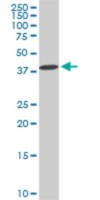 Western Blot: DCPS Antibody (1G4) [H00028960-M02]