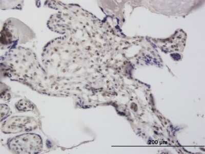 Immunohistochemistry-Paraffin: DCPS Antibody (3E5) [H00028960-M03]