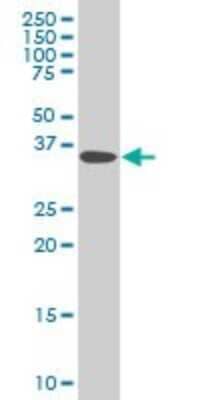 Western Blot: DCPS Antibody (3E5) [H00028960-M03]