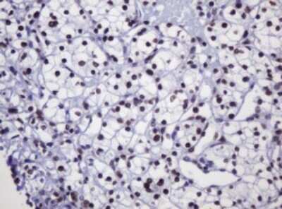 Immunohistochemistry: DCPS Antibody (OTI4H8) [NBP2-45650]
