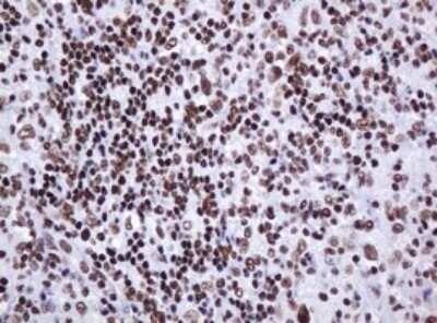 Immunohistochemistry: DCPS Antibody (OTI4H8) [NBP2-45650]