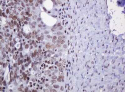 Immunohistochemistry: DCPS Antibody (OTI4H8) [NBP2-45650]