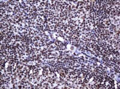 Immunohistochemistry: DCPS Antibody (OTI4H8) [NBP2-45650]