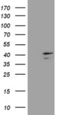 Western Blot: DCPS Antibody (OTI4H8) [NBP2-45650]