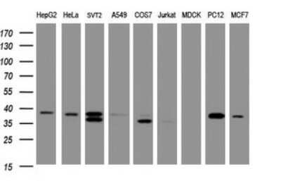Western Blot: DCPS Antibody (OTI4H8) [NBP2-45650]