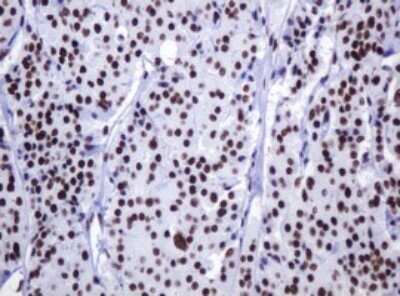 Immunohistochemistry: DCPS Antibody (OTI4H8) - Azide and BSA Free [NBP2-71839]