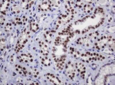 Immunohistochemistry: DCPS Antibody (OTI4H8) - Azide and BSA Free [NBP2-71839]