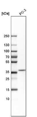 Western Blot: DCPS Antibody [NBP1-81749]