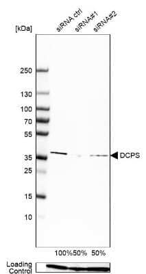 Western Blot: DCPS Antibody [NBP1-81749]