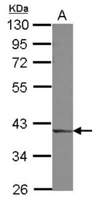 Western Blot: DCPS Antibody [NBP2-16110]