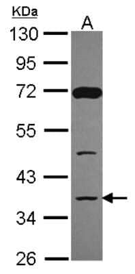 Western Blot: DCPS Antibody [NBP2-16111]