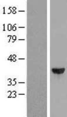 Western Blot: DCPS Overexpression Lysate [NBL1-09747]