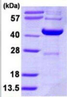 SDS-PAGE: Recombinant Human DCPS His Protein [NBP1-72406]