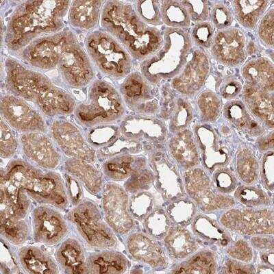 Immunohistochemistry-Paraffin: DCST1 Antibody [NBP2-31817]