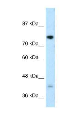 Western Blot: DCST1 Antibody [NBP1-59775]