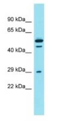 Western Blot: DCST2 Antibody [NBP3-09703]