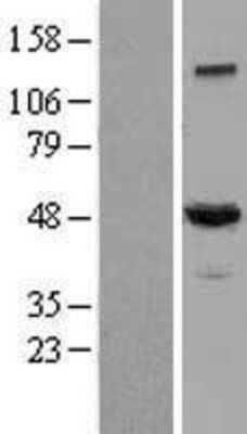 Western Blot: Dynactin Subunit 2/DCTN2/DCTN-50 Overexpression Lysate [NBL1-09750]