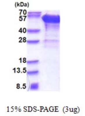 SDS-PAGE: Recombinant Human Dynactin Subunit 2/DCTN2/DCTN-50 His Protein [NBP2-23010]