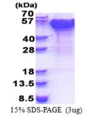 SDS-PAGE: Recombinant Human Dynactin Subunit 2/DCTN2/DCTN-50 His Protein [NBP2-23011]