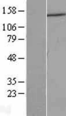 Western Blot: Dynactin Subunit 1/DCTN1 Overexpression Lysate [NBL1-09749]