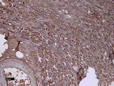 Immunohistochemistry-Paraffin: DCTN3 Antibody [NBP1-52105]
