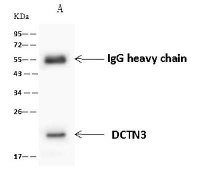 Immunoprecipitation: DCTN3 Antibody [NBP2-98673]