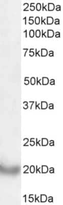 Western Blot: DCTN3 Antibody [NBP1-52105]