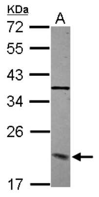 Western Blot: DCTN3 Antibody [NBP2-16114]