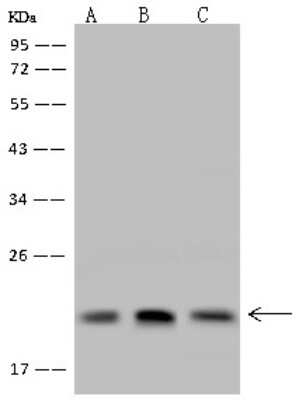 Western Blot: DCTN3 Antibody [NBP2-98673]