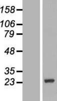 Western Blot: DCTN3 Overexpression Lysate [NBL1-09752]