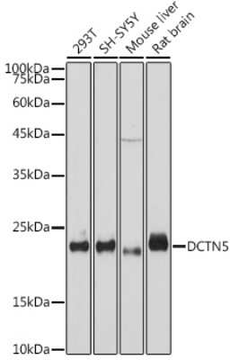 Western Blot: DCTN5 Antibody (9W2S4) [NBP3-15714]