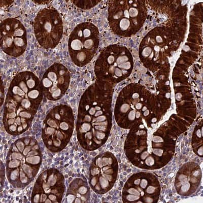 Immunohistochemistry-Paraffin: DCTN5 Antibody [NBP1-81122]
