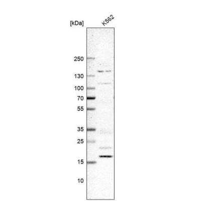 Western Blot: DCTN5 Antibody [NBP1-81122]