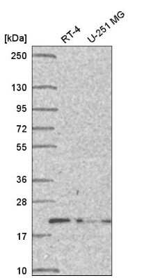 Western Blot: DCTN5 Antibody [NBP2-57058]