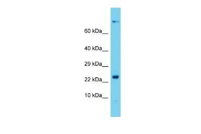 Western Blot: DCTN5 Antibody [NBP2-84762]