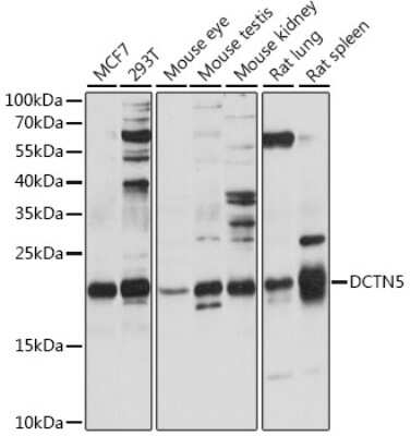 Western Blot: DCTN5 AntibodyAzide and BSA Free [NBP2-92279]