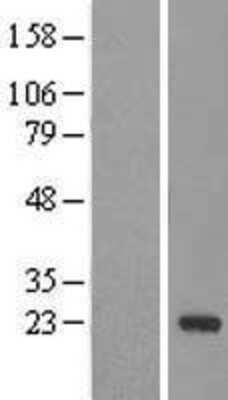 Western Blot: DCTN5 Overexpression Lysate [NBL1-09754]