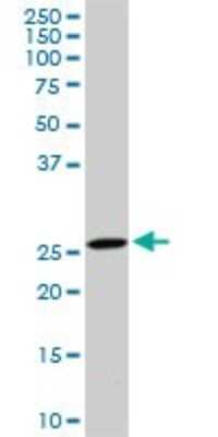 Western Blot: DCUN1D1 Antibody (3D7) [H00054165-M01]
