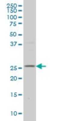 Western Blot: DCUN1D1 Antibody (3D7) [H00054165-M01]