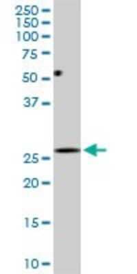 Western Blot: DCUN1D1 Antibody (3D7) [H00054165-M01]