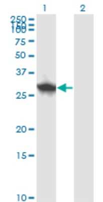 Western Blot: DCUN1D1 Antibody (3D7) [H00054165-M01]